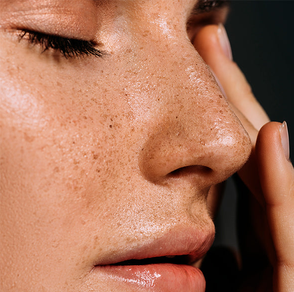 A routine for oily skin: tackling blemishes